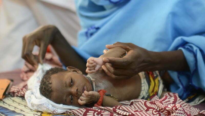 ΣΟΚ: Από υποσιτισμό απειλούνται 6,5 εκατομμύρια παιδιά στην Αφρική