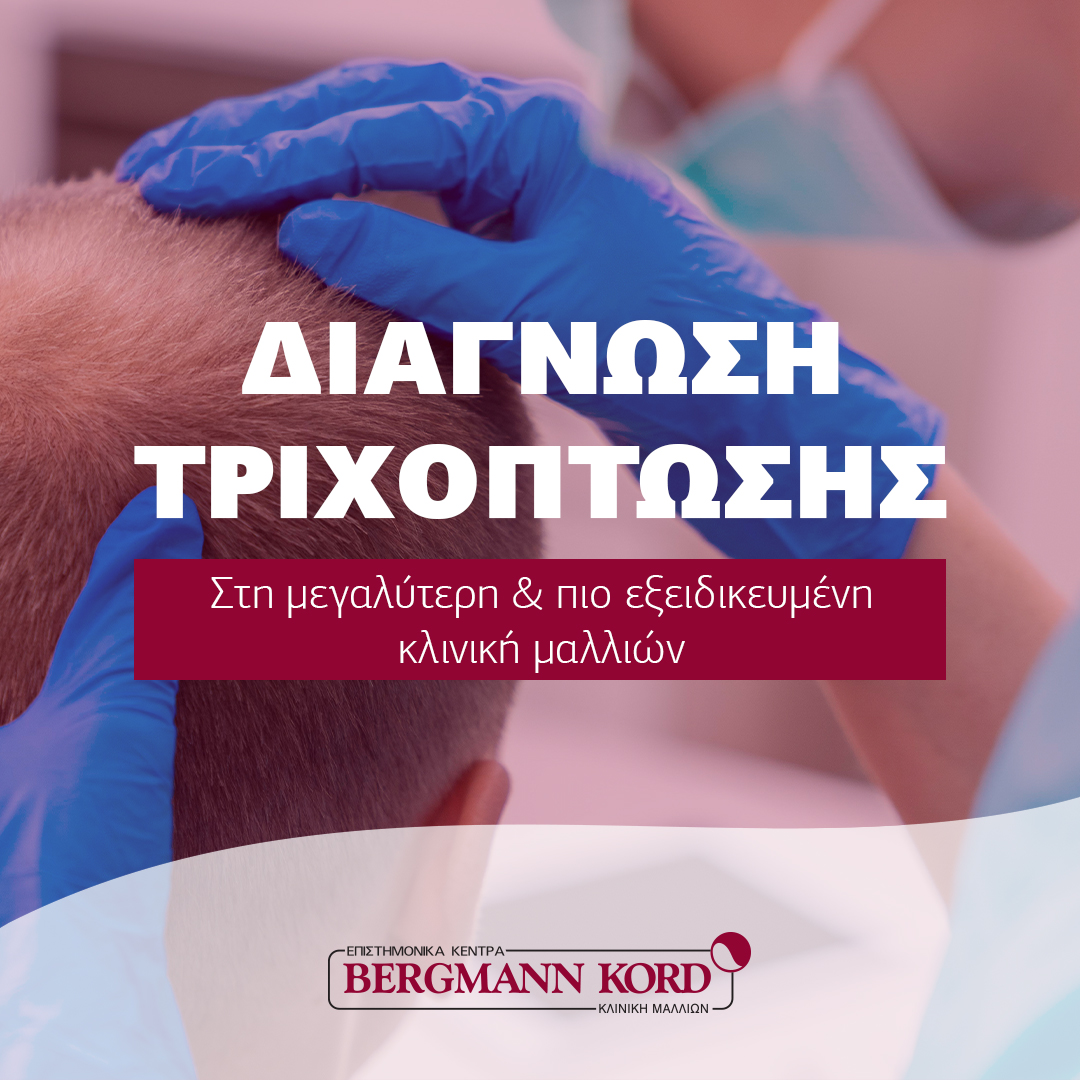 Η διάγνωση της τριχόπτωσης