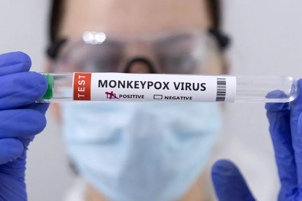 Οκτώ νέα κρούσματα ευλογιάς των πιθήκων την τελευταία εβδομάδα – 80 συνολικά σε όλη την επικράτεια
