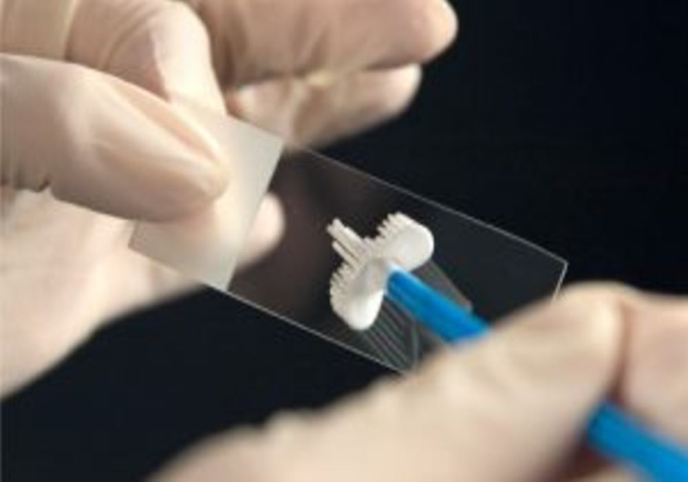 Δ. Θεσσαλονίκης: Δωρεάν Τεστ Παπ με αφορμή την Παγκόσμια Ημέρα της Γυναίκας