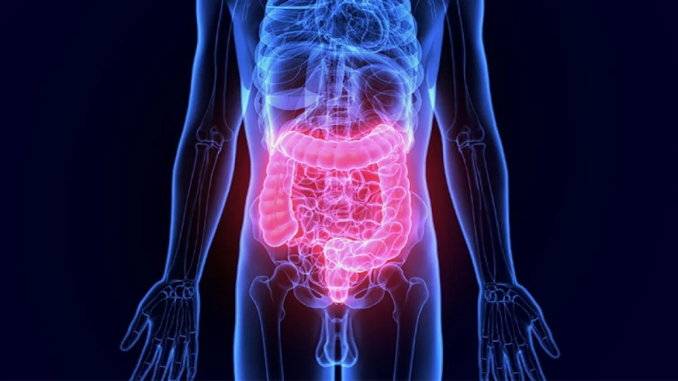 Καρκίνος του παχέος εντέρου: Ο άγνωστος κίνδυνος που κρύβει για την καρδιά