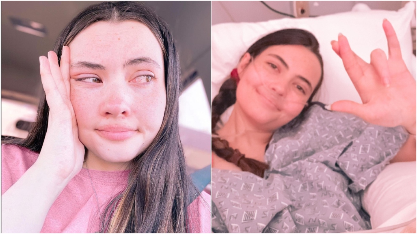 Αλλεργία στο νερό: 25χρονη από τις ΗΠΑ περιγράφει πώς ζει – «Δεν μπορώ ούτε να δακρύσω, βγάζω εξανθήματα»