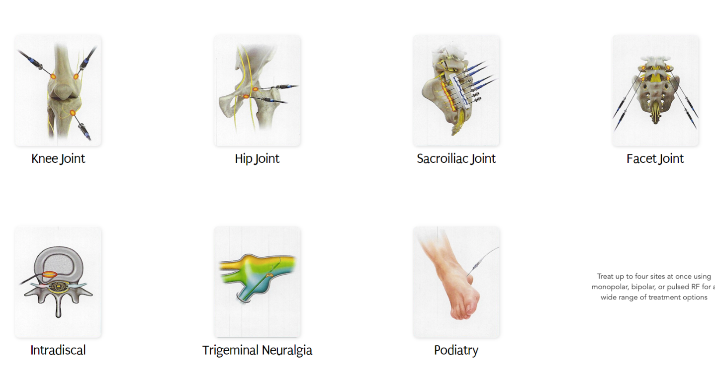 Μη χειρουργική θεραπεία χρόνιων επώδυνων παθήσεων