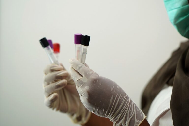 Πειραματική εξέταση αίματος προβλέπει τον κίνδυνο εμφάνισης ασθενειών που σχετίζονται με τη γήρανση