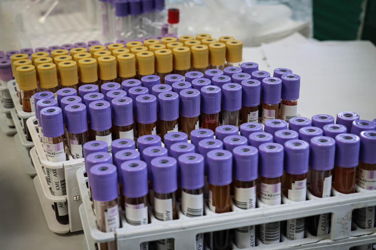 Θεσσαλονίκη: Έκτακτη Αιμοδοσία στο δήμο Νεάπολης – Συκεών τη Δευτέρα 26και την Τρίτη 27 Αυγούστου