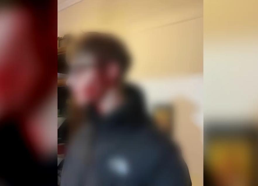 Θεσσαλονίκη: Αυτόπτης μάρτυρας της επίθεσης στο ζευγάρι ανηλίκων «Η κοπέλα φώναζε βοήθεια, γινόταν χαμός» (Video)