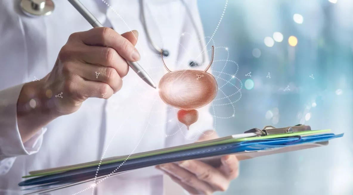 Αιματουρία: Ένας στους πέντε ασθενείς με αίμα στα ούρα θα εμφανίσει καρκίνο ουροδόχου κύστης