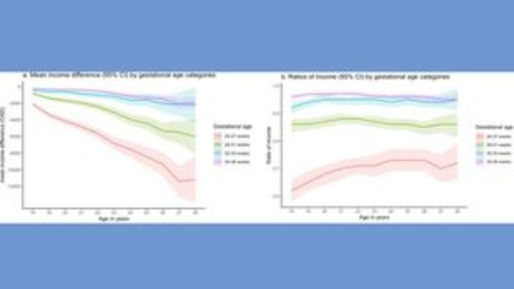 Έρευνα διαπιστώνει ότι οι επιπτώσεις της προωρότητας επεκτείνονται στην ενήλικη ζωή