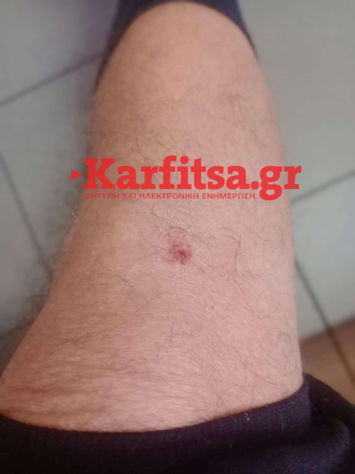 Άγρια επίθεση σε ντελιβερά στη Θεσσαλονίκη: «Μου πέταξε καρέκλα και με απείλησε με γκασμά και κατσαβίδι»