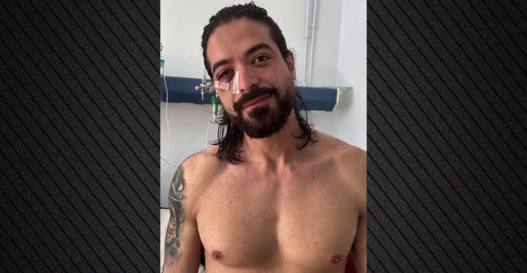 Ο Άρης Μουγκοπέτρος ανέβασε βίντεο μετά τον ακρωτηριασμό του – “Νόμιζα ότι ήταν καπνογόνο…”