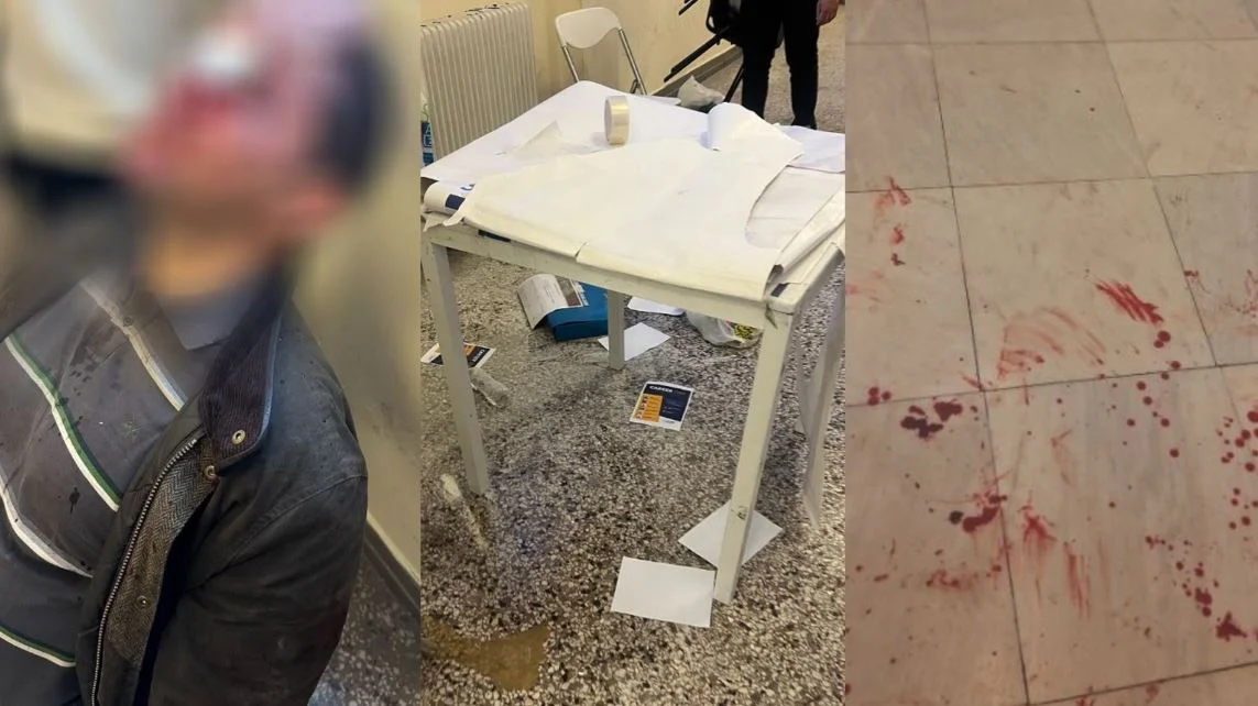 Άγρια επίθεση σε εκδήλωση – Κουκουλοφόροι τραυμάτισαν φοιτητή