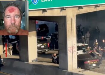 Λος Άντζελες: Αστυνομικός πυροβόλησε με πλαστική σφαίρα φωτογράφο στο κεφάλι (Video)