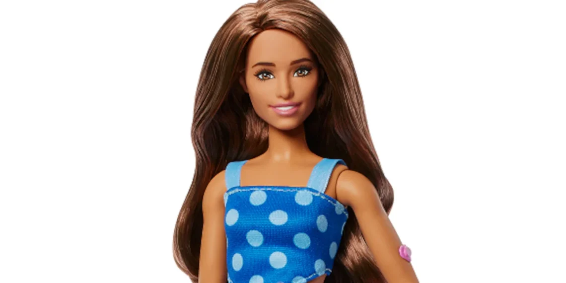 Η Barbie λανσάρει την πρώτη κούκλα με σακχαρώδη διαβήτη τύπου 1