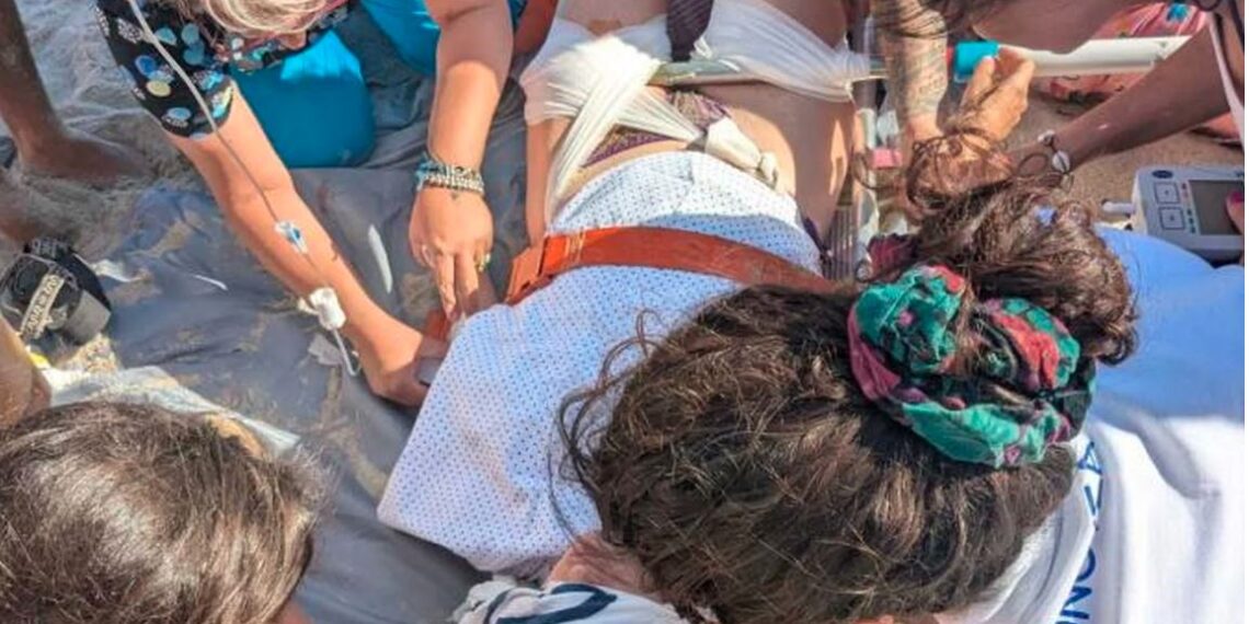 Σοκαριστικό ατύχημα στη Δονούσα: Κοντάρι ομπρέλας καρφώθηκε στο πόδι νεαρής! (φωτό)