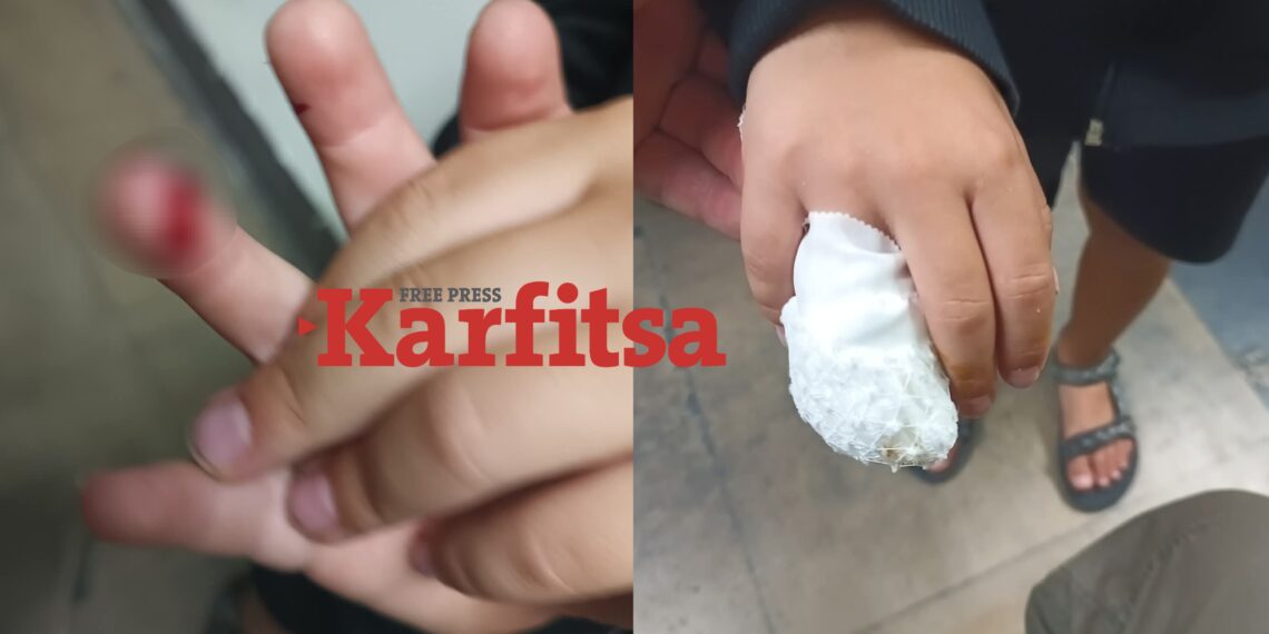 Δράμα: 8χρονο παιδί στο νοσοκομείο μετά από τραυματισμό σε παιχνίδι παιδικής χαράς - Τι απαντά ο δήμος (ΦΩΤΟ+Video)
