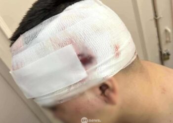 Συκιές: Συνολικά 11 άτομα επιτέθηκαν στον 13χρονο – Στον εισαγγελέα ο 18χρονος