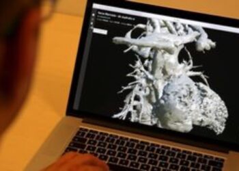 Τα καρδιαγγειακά επεισόδια συνδέονται με γνωστούς παράγοντες κινδύνου