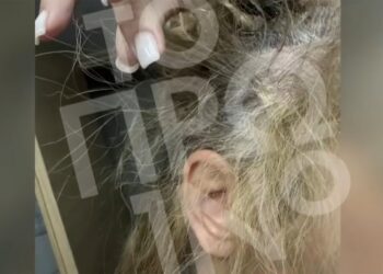 Άγρια επίθεση γνωστού πλαστικού χειρουργού σε 43χρονη στη μέση της Συγγρού (video)