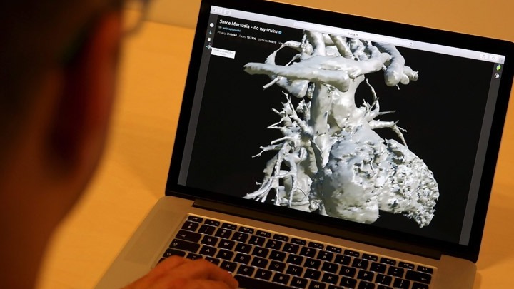 Η εξάπλωση της καρδιακής ανεπάρκειας έχει πάρει τη μορφή πανδημίας, κυρίως στην τρίτη ηλικία