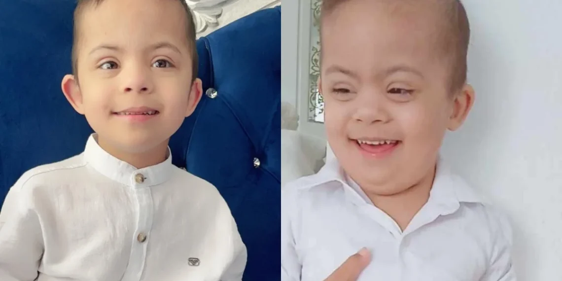 Πράξη Αγάπης: Έκκληση βοήθειας για τον 5χρονο Άρη με σύνδρομο Down