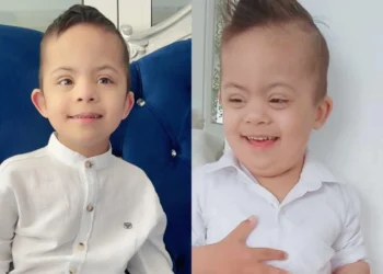 Πράξη Αγάπης: Έκκληση βοήθειας για τον 5χρονο Άρη με σύνδρομο Down