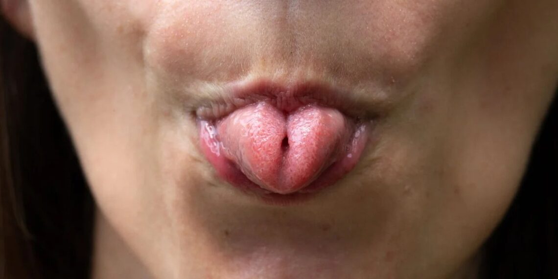 Εσείς ξέρετε τι σημαίνει ψυχολογικά η ικανότητα να διπλώνετε τη γλώσσα σας σε σχήμα «U»;