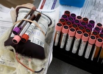 Εθελοντική αιμοδοσία στο ΑΠΘ στις 11 Μαΐου με δυνατότητα δωρεάς αιμοπεταλίων