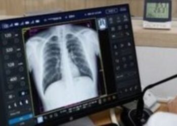Κυστική Ίνωση: 500.000 φορείς και πάνω από 900 οι ασθενείς στην Ελλάδα